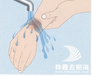 冷水冷却烫伤处